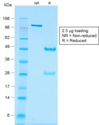 Data from SDS-PAGE analysis of Anti-Wilm s Tumor 1 antibody (Clone rWT1/857). Reducing lane (R) shows heavy and light chain fragments. NR lane shows intact antibody with expected MW of approximately 150 kDa. The data are consistent with a high purity, intact mAb.